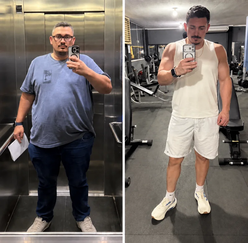 Comparação de acompanhamento autorizada, antes e depois