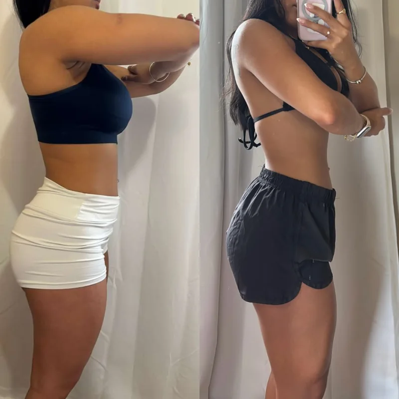 Comparação lateral de acompanhamento autorizada, antes e depois